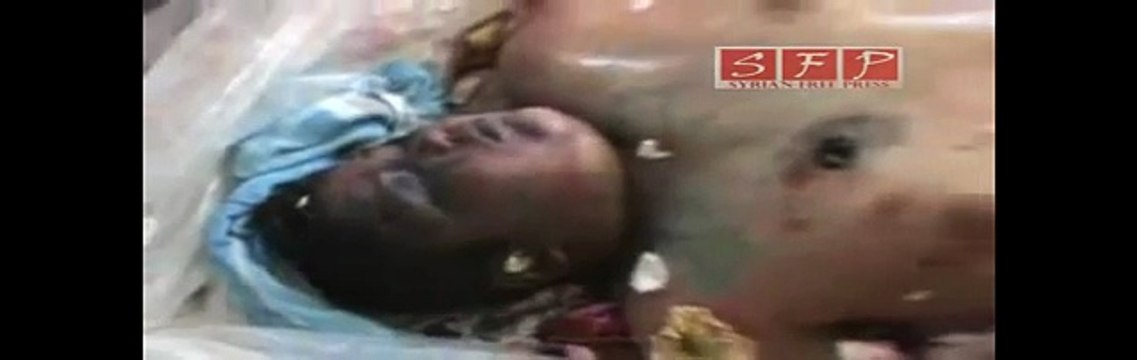 الشهيد حمزة الخطيب الجيزة بعد أن تم تعذيبه من الشبيحة