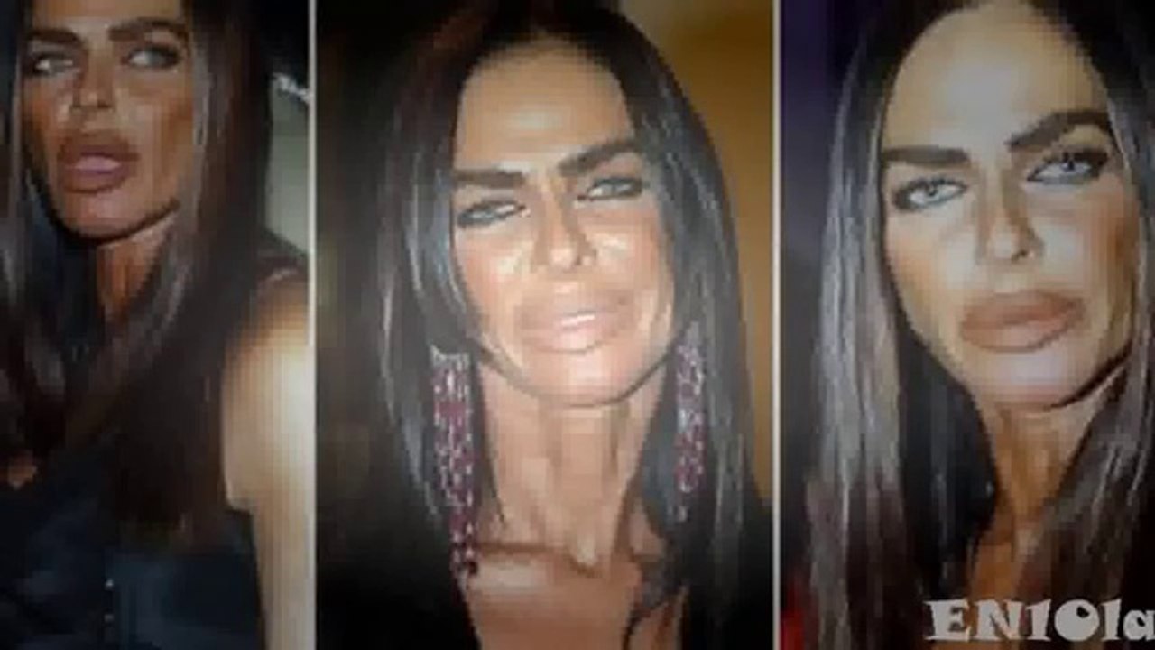 Dünyanın En Kötü 10 Estetik Ameliyatı Olan Kadınları