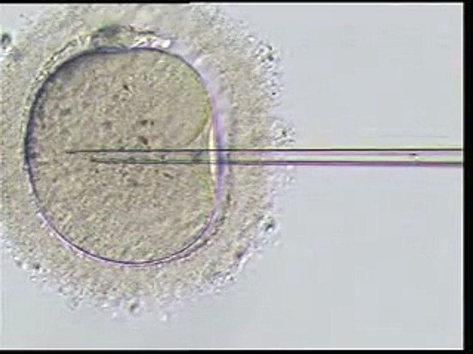 about infertility and ivf threatments icsi video.flv http://www.turkey-ivf.com