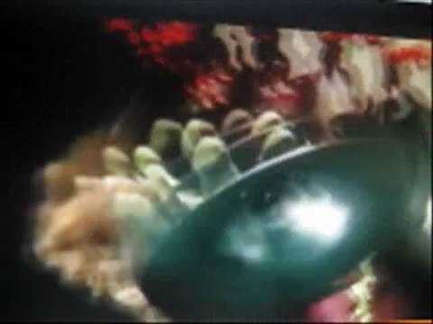 Цирковые уроды. Мальчик-лобстер