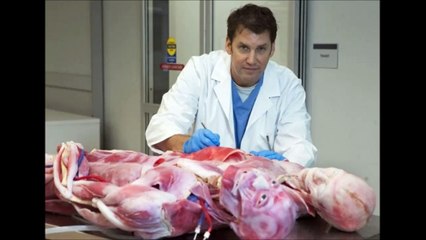 【閲覧注意】 脈打つ心臓、流れる血液。リアルな人間に最も近い合成人体が開発される（閲覧注意）Synthetic human body closest to the human is too real