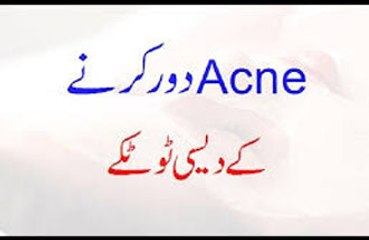 Acne Door Karne Ke Desi Totkay