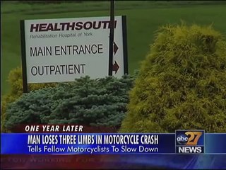 Triple amputee has warning for motorcyclists