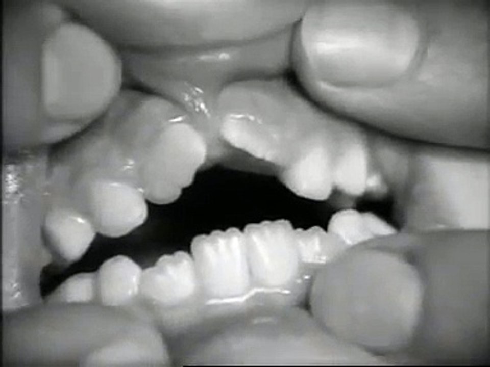 100 jaar tandheelkunde in Nederland en tentoonstelling Openbaar Kunstgebit