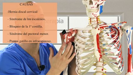 Скачать видео: ¿Qué es la cérvico-braquialgia o dolor cervical irradiado y cuáles son sus causas y síntomas?