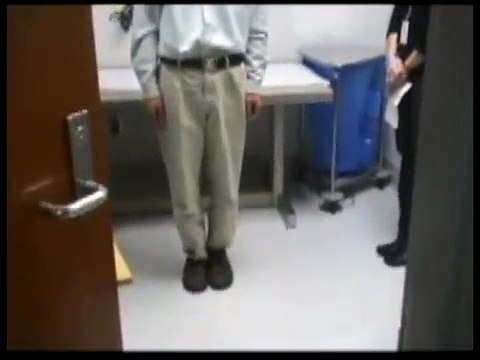 6.5. Spinocerebellar Ataxia-Type-7 - Cerebellar Ataxia [Springer Video Atlas]