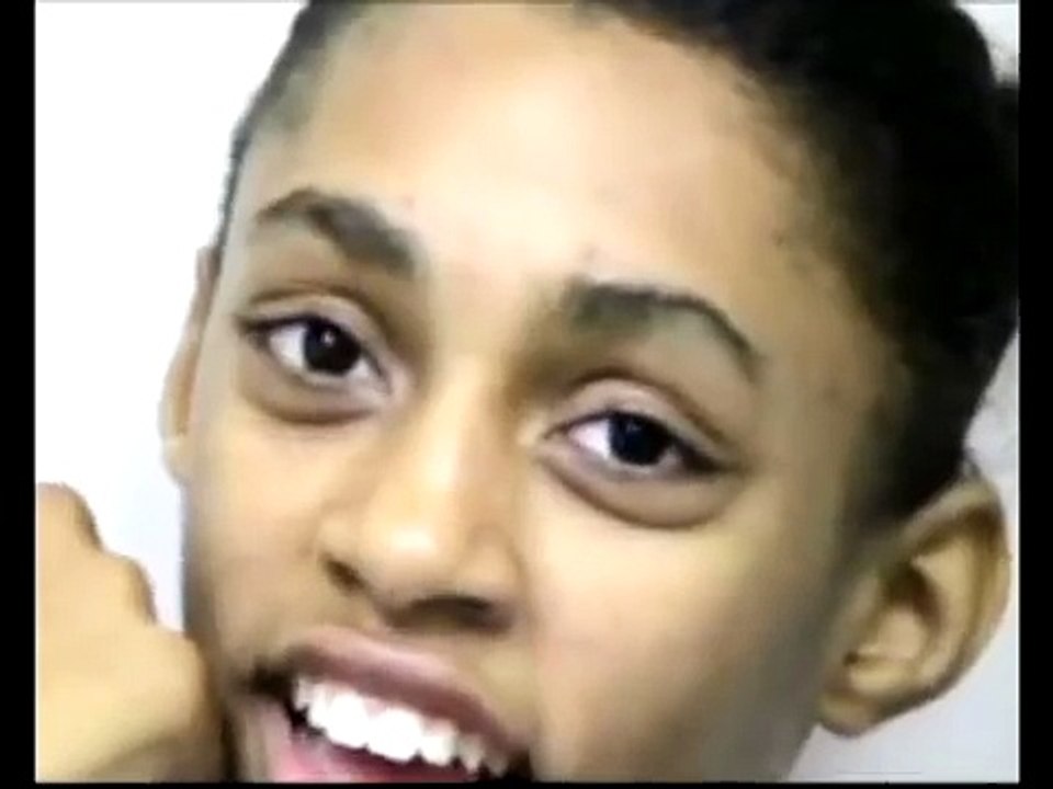 4.3. Juvenile Huntington's Disease - Choreiform Disorders [Springer Video Atlas]