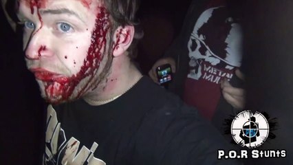 Un gars heureux d'avoir le visage en sang après un accident