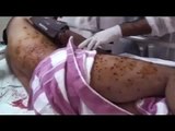 Bahrain Nasty vid of 100s of shots on Peaceful protester البحرين معارضة