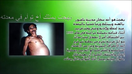 أغرب 5 أشخاص في العالم