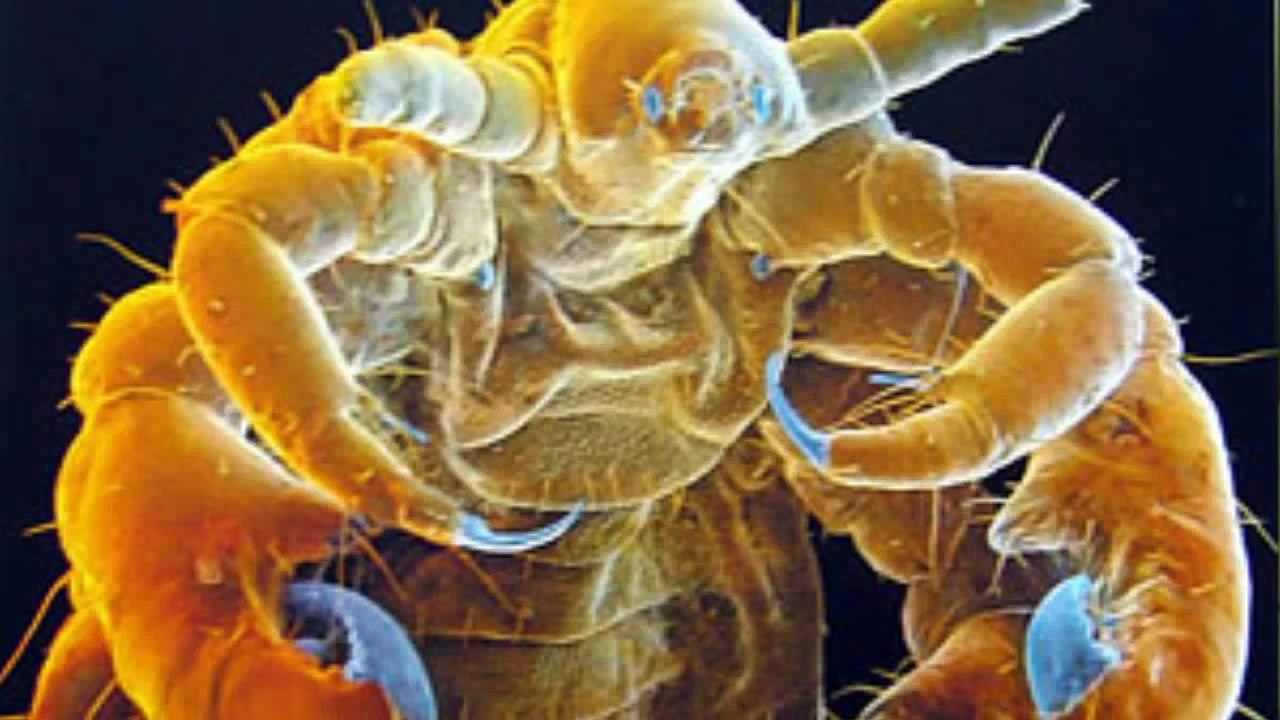 PENE DE 75 METROS. Los piojos. El pene más grande en proporción