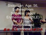 Calmodulin helps in Systemic Lupus Erythematosus (SLE)