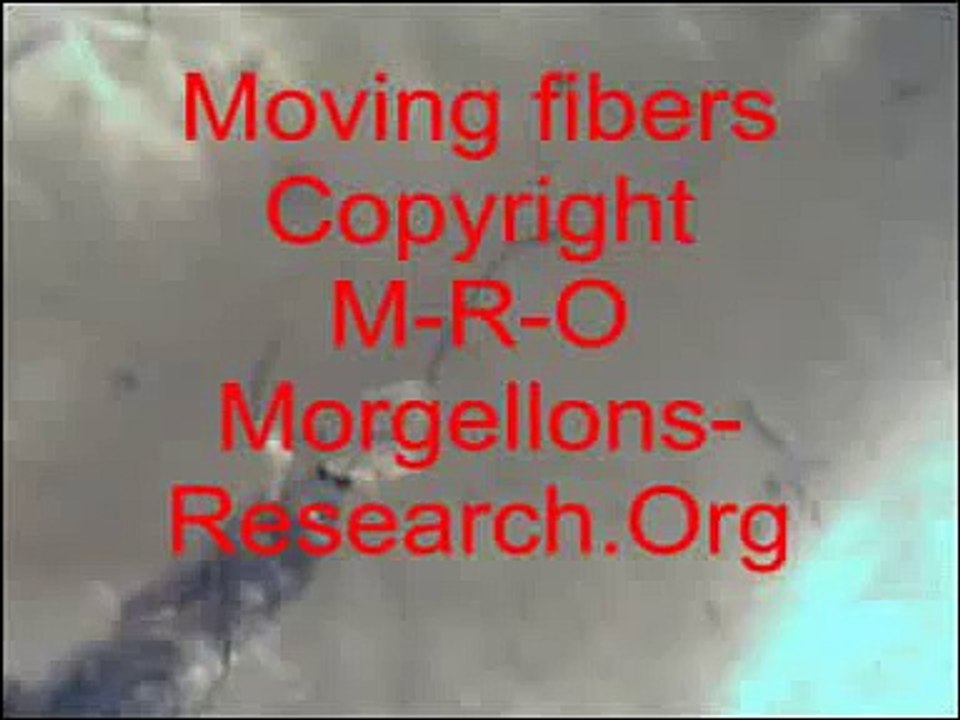 Moving Morgellons fibers