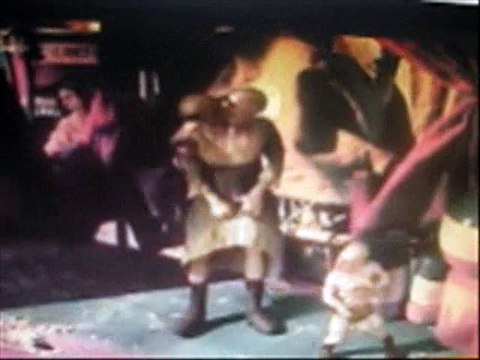 Цирковые уроды. Девушка-змея