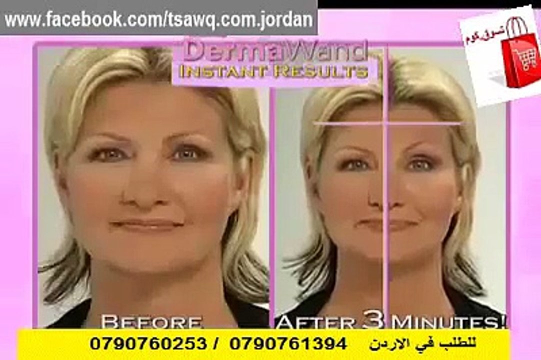 لحل مشاكل البشرة وتقدم السن و شد التجاعيد Derma wand