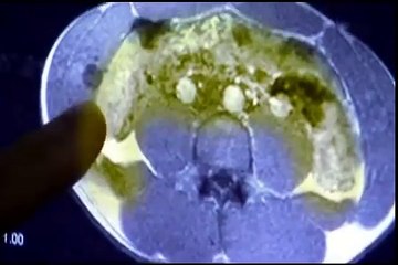 Asafa Powell Dokumentation Teil3/4