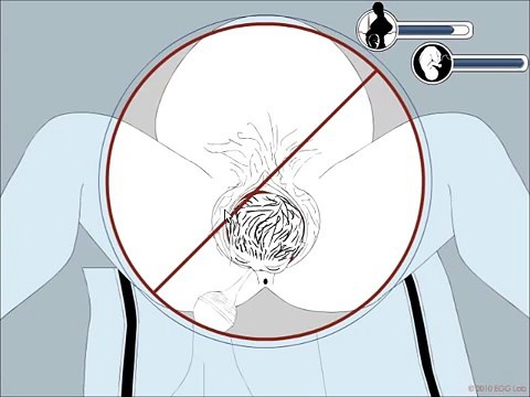 Emergency Birth Simulator (Contains nudity, but not in a cool way)