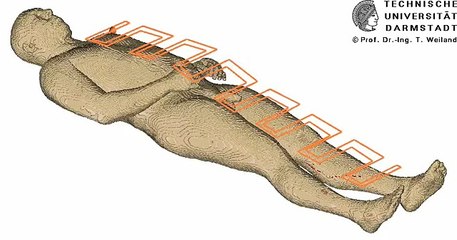 Current density inside the body induced by an electric blank