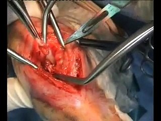 ROTTURA CROCIATO ANTERIORE CANE  Dott Alessandro Prota www.alessandroprota.it