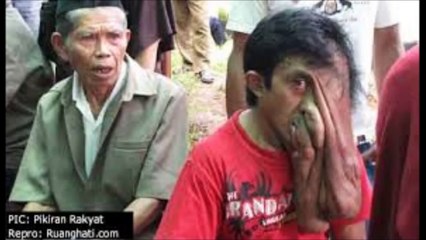 【閲覧注意】グロ注意、巨大な腫瘍を持つ人々