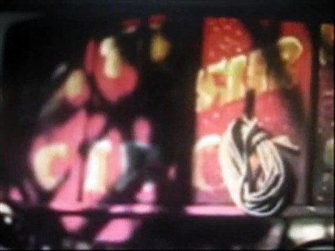 Цирковые уроды. Человек с деформацией позвоночника