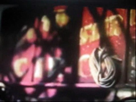 Цирковые уроды. Человек-тюлень