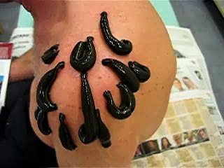 Therapy with leeches/Blutegel/bloedzuigers (Belgium) (31)