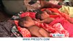Somali woman gives birth to quadruplets