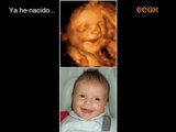 Ecografías: el parecido de los bebés antes y después de nacer