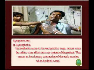 Rabies history symptoms and treatment Read Daily
