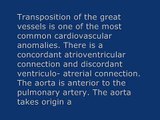 TGA Transposition of great arteries