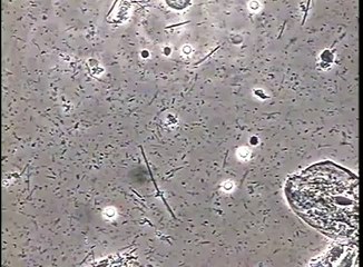 Bacterias causantes de la caries dental: ''Streptococcus mutans''.