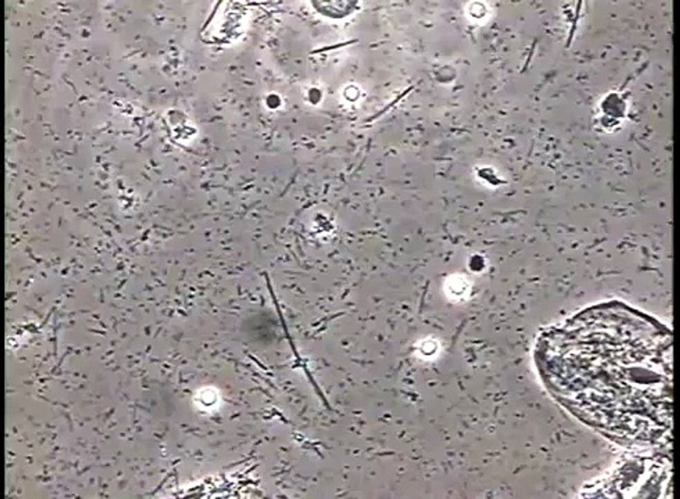 Bacterias causantes de la caries dental: ''Streptococcus mutans''.