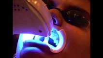 Clareamento Dentário - Dúvidas Frequentes