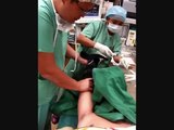 Manipulation Under Anaesthesia of Frozen Shoulder by Dr HC Chang.wmv