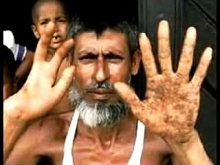 Minería Contaminante Actores famosos denuncian