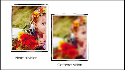 Treatments and Surgery