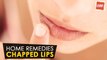 Chapped Lips - Home Remedies | Health Tips