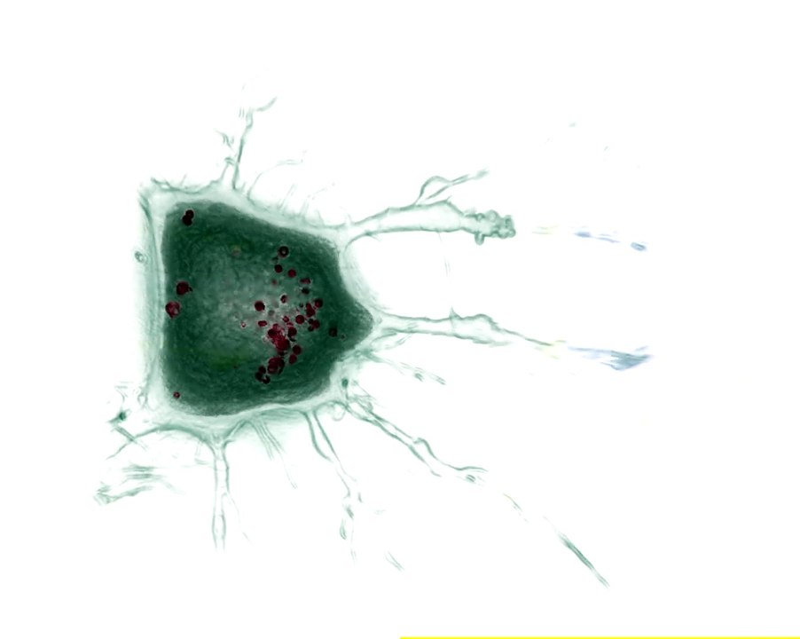 Dying_Cell