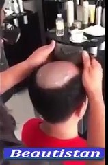 1 minute mai apny ganjay pan ko dur kary...............