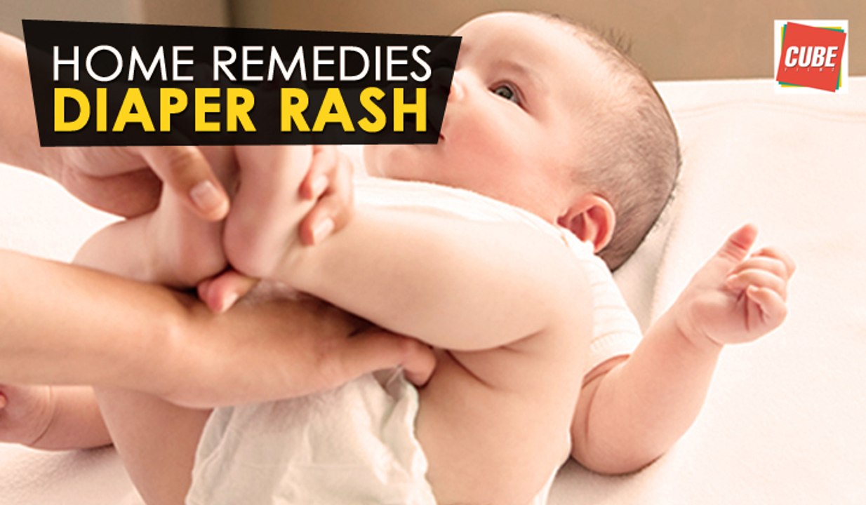 Diaper Rash - Home Remedies | Health Tips