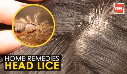 Head lice - Home Remedies | Health Tips