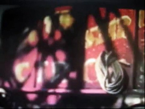 Цирковые уроды. Человек с двумя лицами