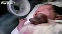Baby Born With Heart Outside His Body [holy shit]