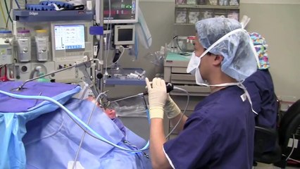 Zenker's Diverticulum Surgery - Endoscopic Staple Diverticulostomy