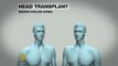 Neurosurgeon to attempt world's first head transplant