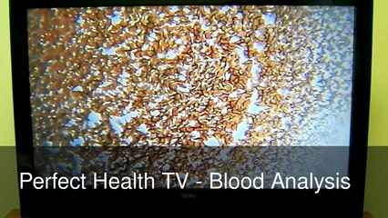 Live Blood Analysis with Batson Miller and Associates Limited