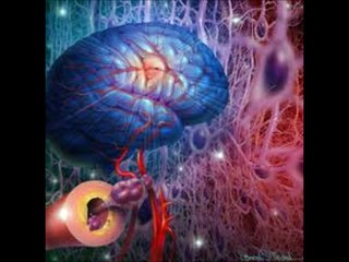 causas y síntomas de un derrame cerebral