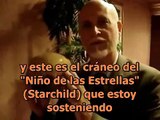 Lloyd Pye - Cráneo de Starchild (Niño de las Estrellas)