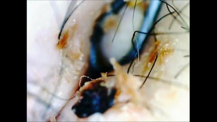 What happens when people don't wash their navel for years :(